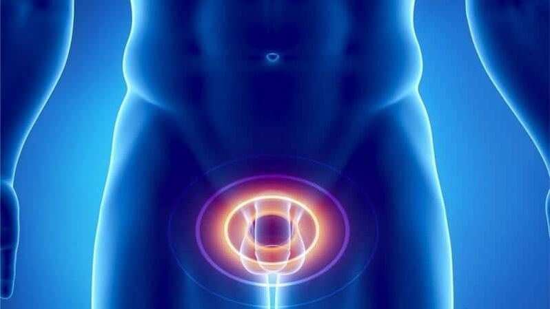 Prostatitis pain